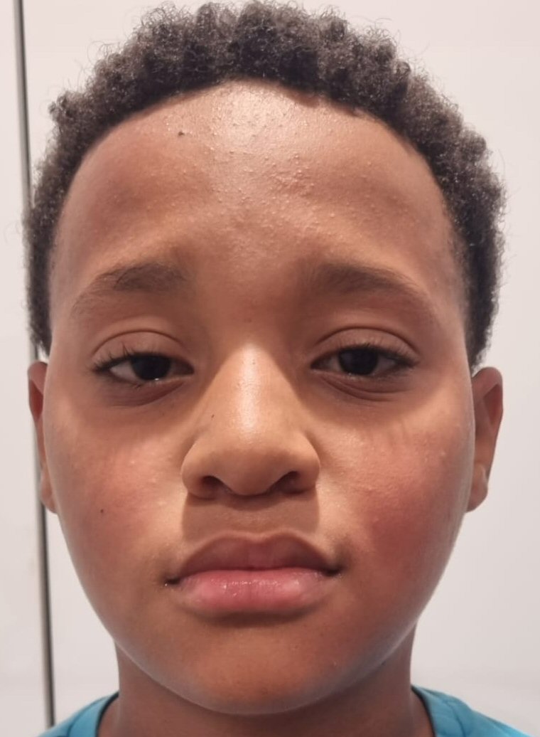 HÍLTON NELSON CARNEIRO TEIXEIRA